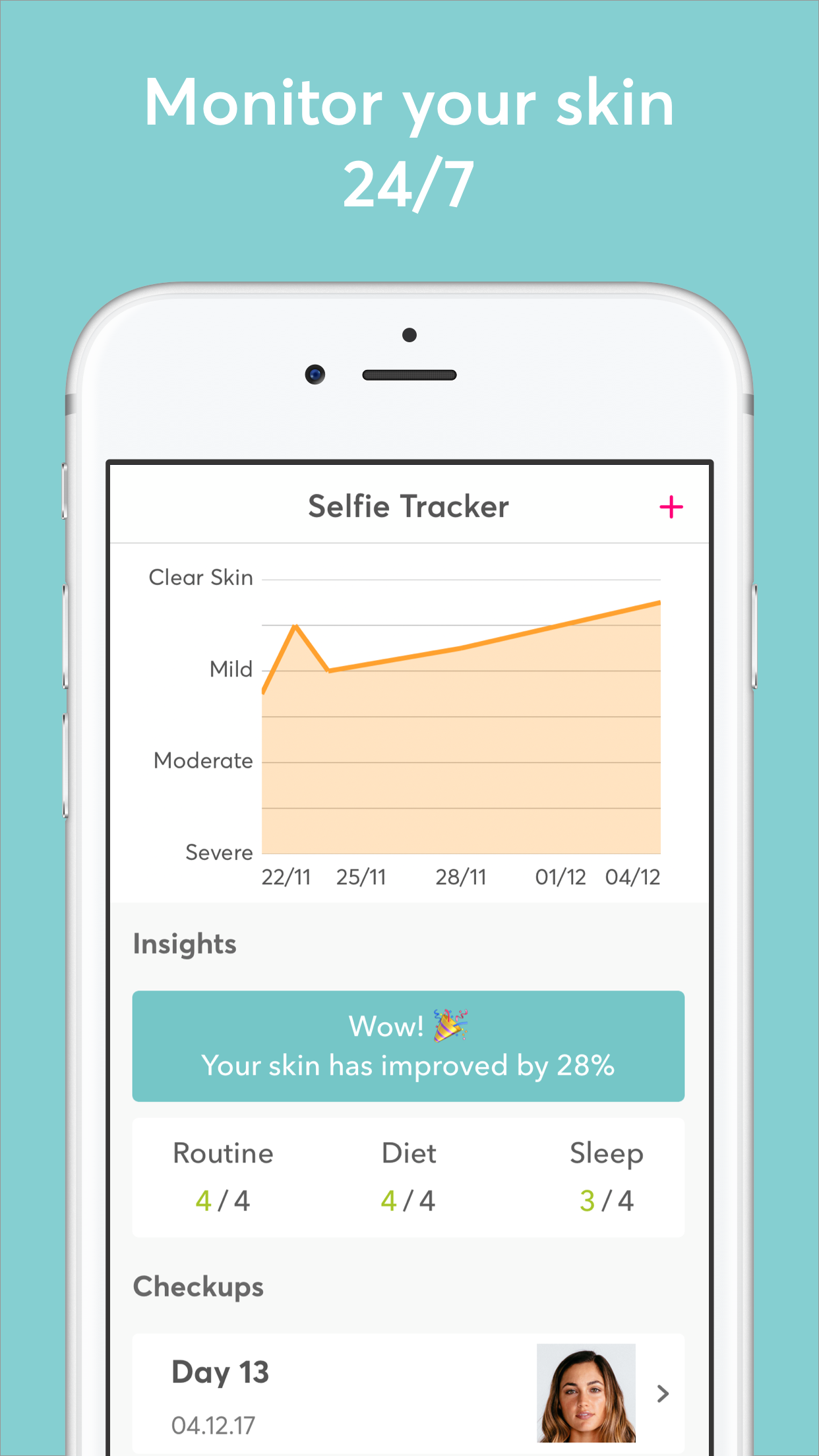 MdAcne Screenshot 3